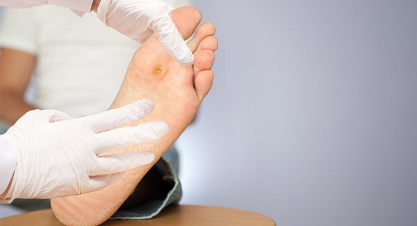 Источник - https://vascul.ru/articles/treatment-of-trophic-ulcers-faq