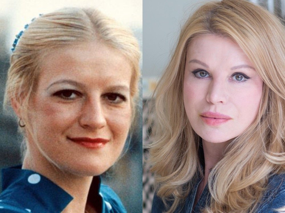 Проклова елена до пластики и после фото - ViktoriaFoto.ru