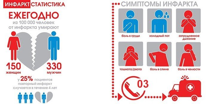 Инфаркт миокарда у женщин. Инфаркт миокарда у женщин и мужчин. Инфаркт миокарда симптомы у женщин. Симптомы инфаркта у мужчины пожилого возраста.