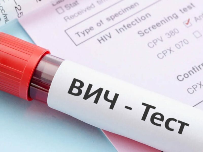 Надо заметить, что у ВИЧ-инфицированных концентрация вируса наиболее высокая в крови, лимфе, сперме, вагинальном секрете и грудном молоке. В слюне, поте, моче, выделениях из нос их крайне мало, потому этого недостаточно для инфицирования другого человека. Разница в концентрации вируса делает одни биологические жидкости опасными, а другие — безопасными. Поэтому не стоит думать, что к таким пациентам недопустимо прикасаться, целовать их или нельзя пользоваться их посудой. Вирус не передаётся при прикосновениях, поцелуях, рукопожатии, даже кашель и чихание ВИЧ-больного никак не может передаваться, вопреки распространённому мнению.
К сожалению, неграмотность в данном вопросе приводит к распространению неверной информации и как следствие страху, что ВИЧ и СПИД — это смертный приговор. Да, это заболевания, при которых иммунная система подвергается жесточайшему испытанию, а человек получает массу неприятных симптомов, но жить с этим можно. Поэтому всегда проходите обследование вовремя, сдавайте тест на ВИЧ.