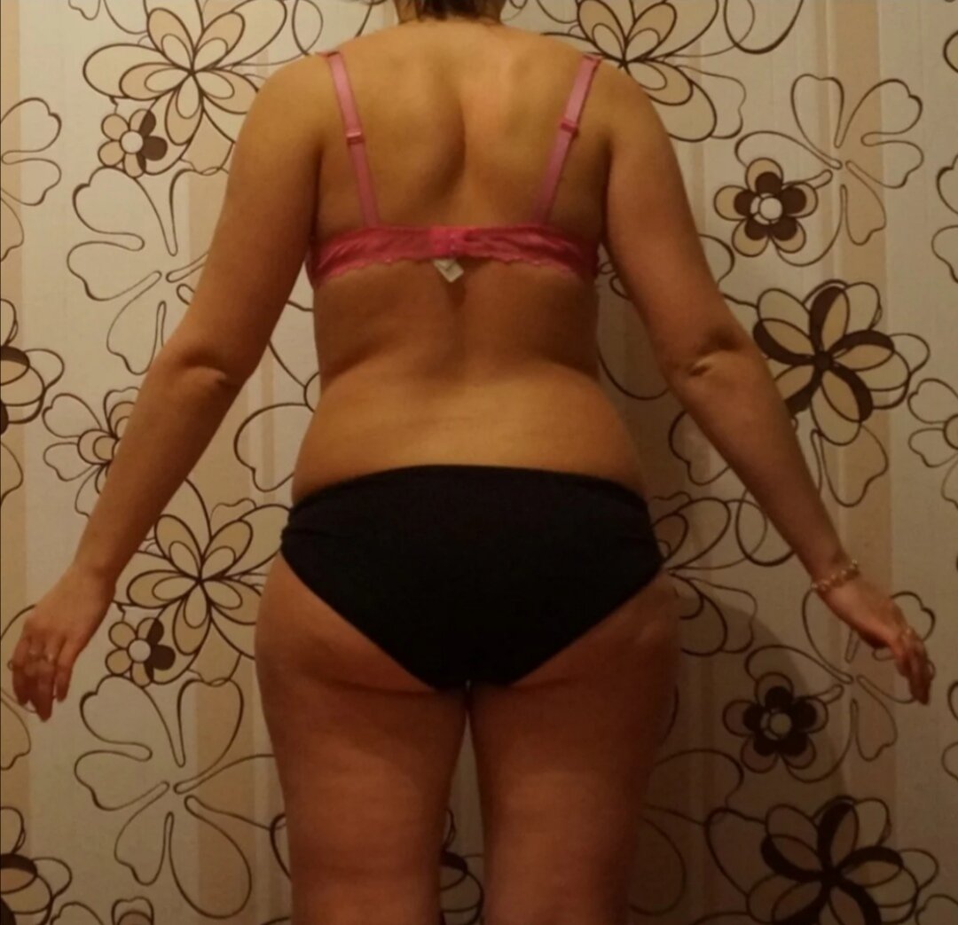 Я до похудения. Прошу прощения за фото. Не входила в мои планы публикация в сети Интернет 