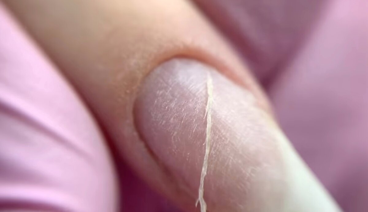 Вот так выглядит срезанная кутикула