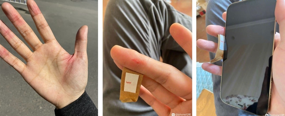 Следы на руках от Айфона