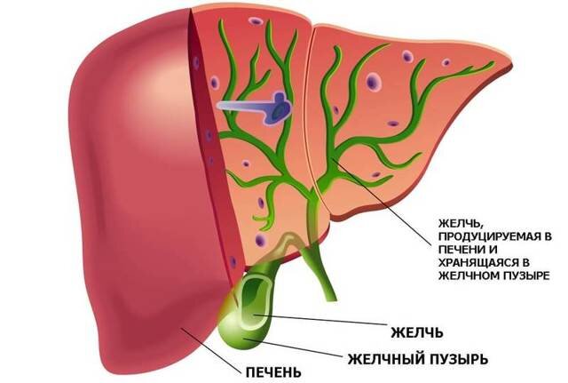 Камни в желчном пузыре