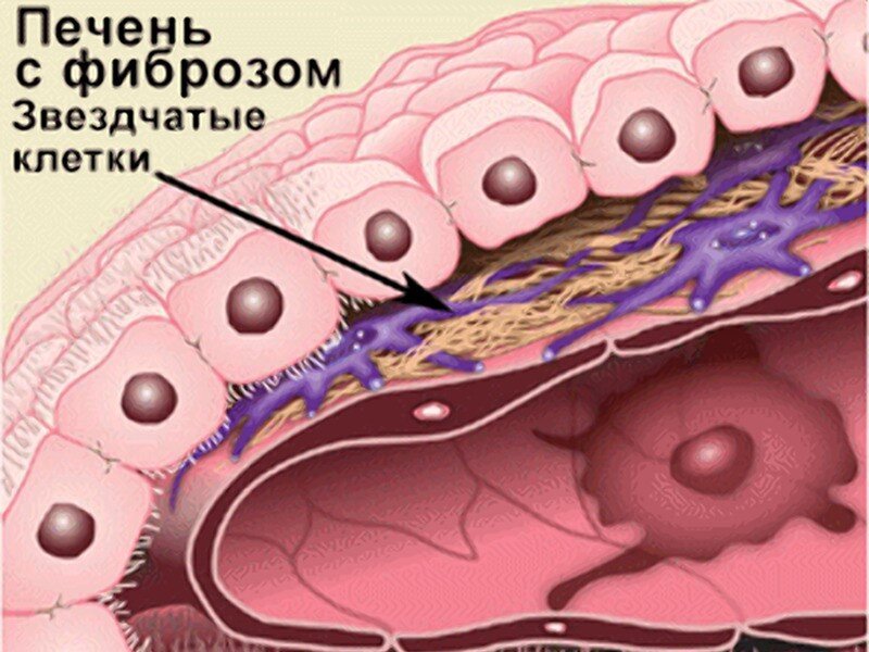 Простатит - причины, симптомы, диагностика, лечение и профилактика