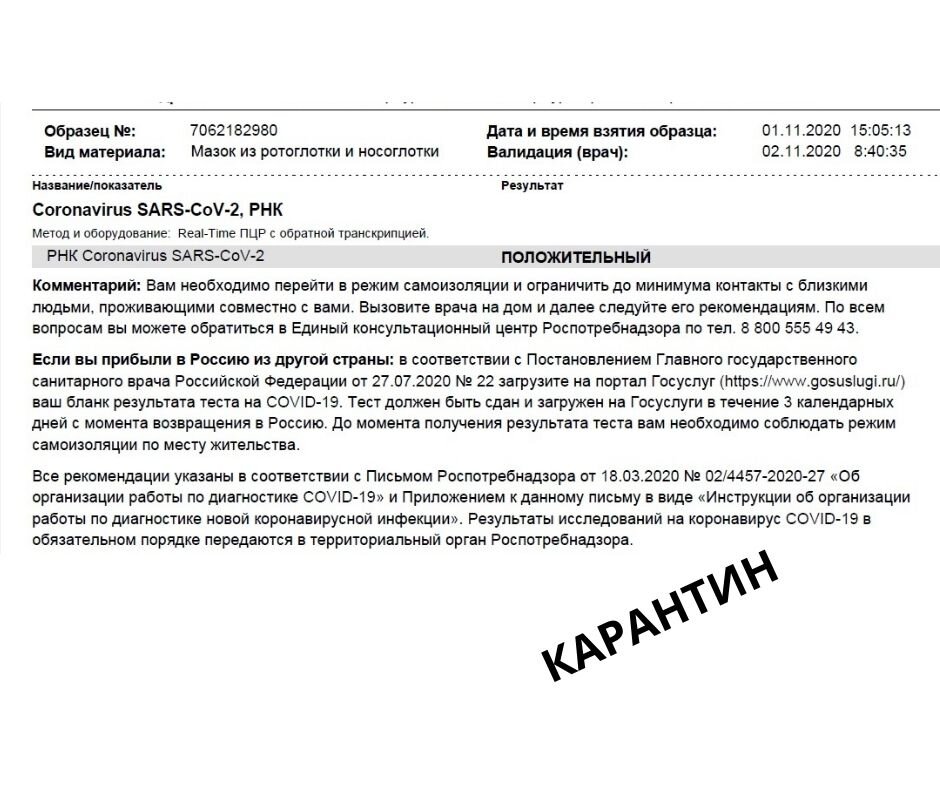 В платной лаборатории тест был готов за 17 часов 35 минут