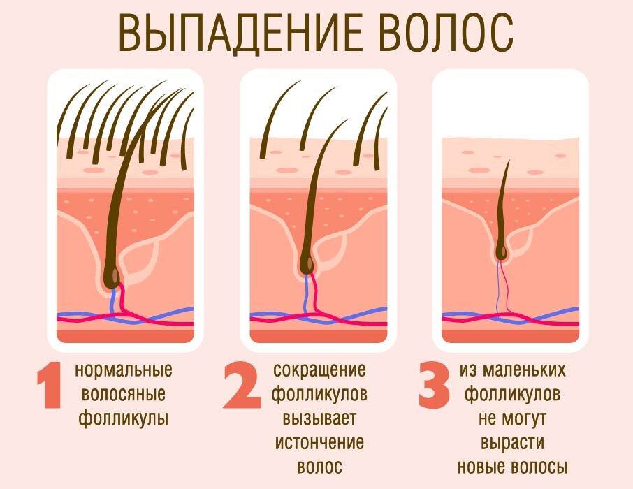 Иллюстрация автора