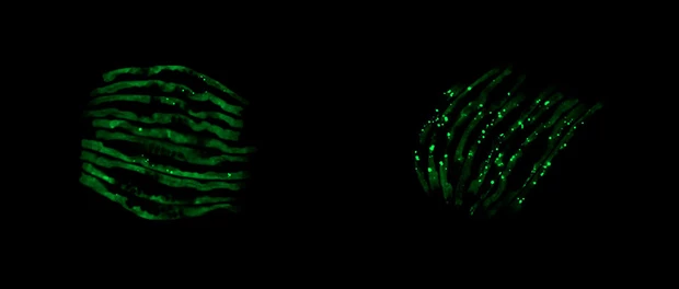 Нормальный C. elegans (слева) по сравнению с червями, зараженными патогенными бактериями © Университет Флориды