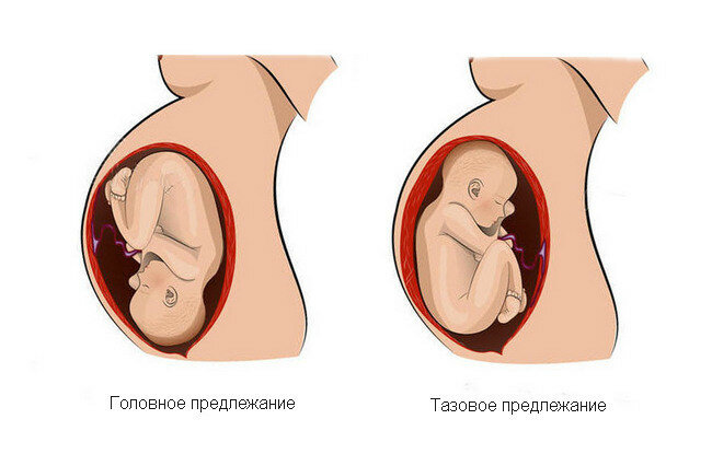34 Weeks Pregnant: Symptoms, Belly, Baby Size & More 38 semanas de gravidez, 37 