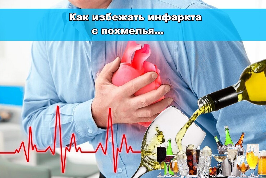 Инфаркт с похмелья
