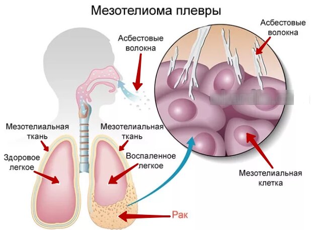 В России используют минерал, запрещённый в 63 странах