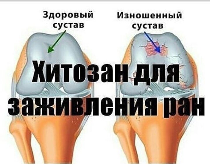 снимает воспаление и востанавливает хрещевую ткань сустава