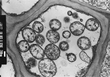 Phytoplasma в клетке флоэмы растения