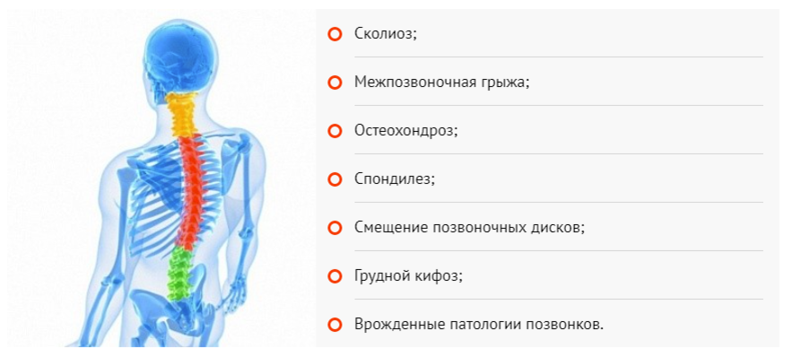Причины боли в спине