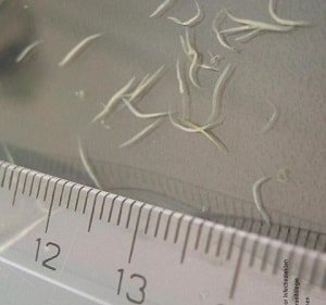 Но для полной уверенности необходима сдача анализов.