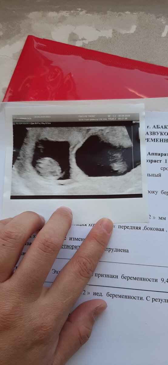 9 недель 4 дня 