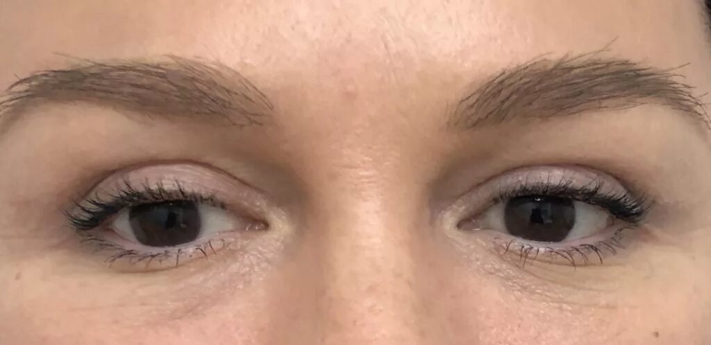 Оперировал пластический хирург Ковалькова Евгения Николаевна