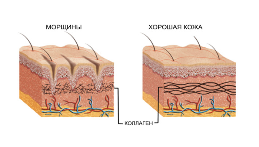 Как коллаген помогает сохранить молодость кожи и убрать морщины? Источник фото: https://clck.ru/Xh9Vy