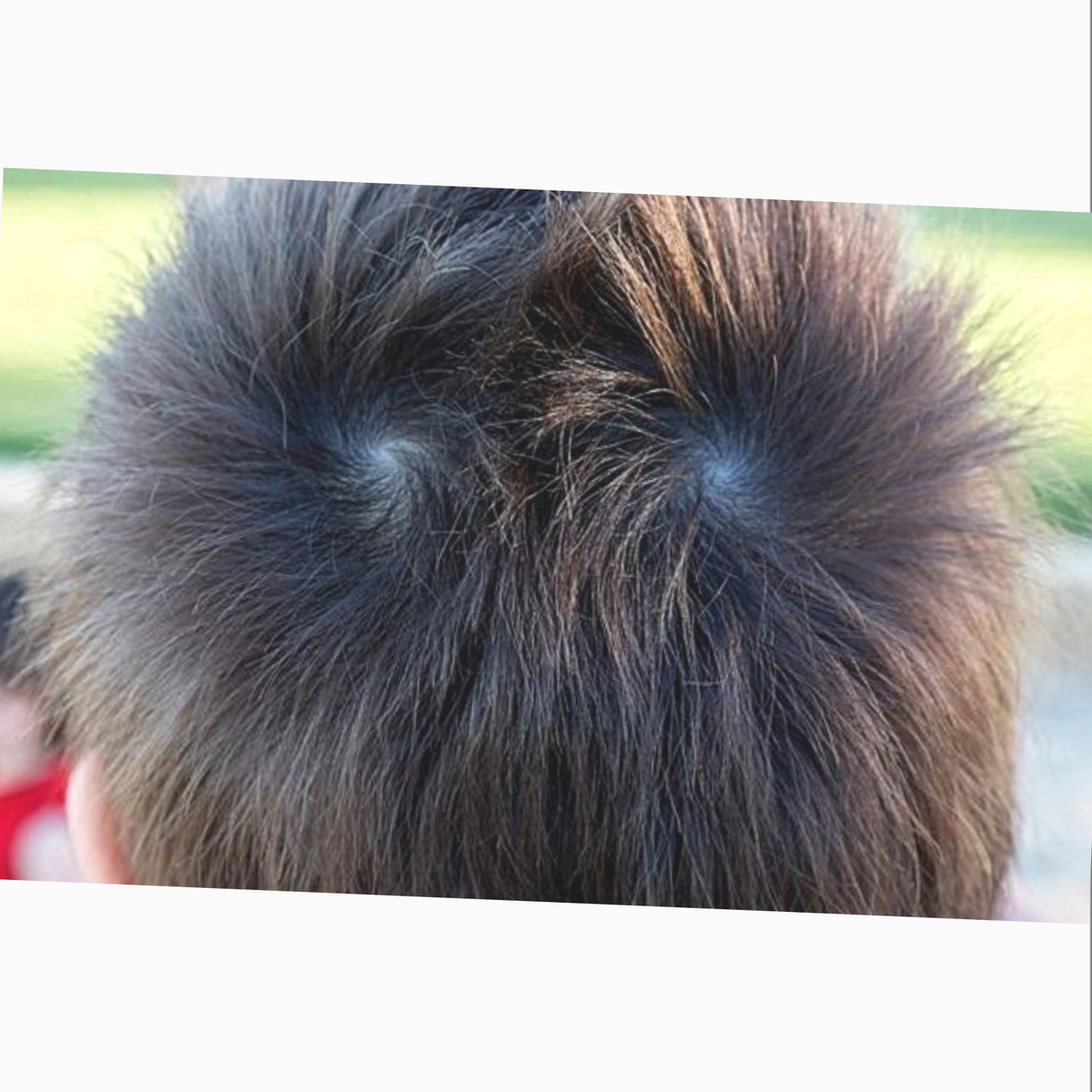 «Почему на макушке волосы короче, относительно всей длины?» — Яндекс Кью