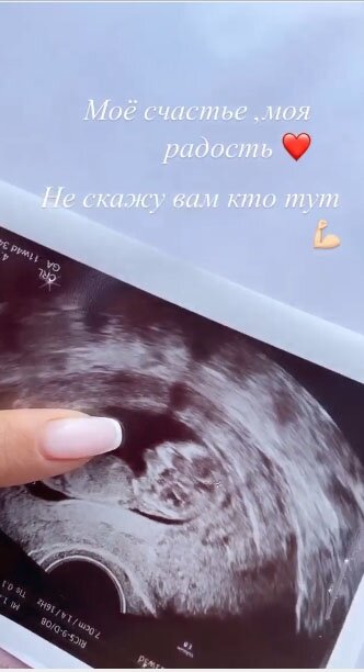 Аня пока не хочет раскрывать пол малыша ​
Фото: «Инстаграм»