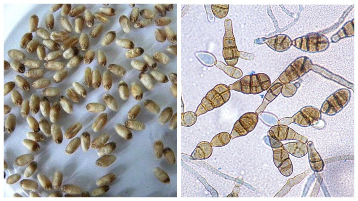 Споры грибов семена. Альтернария (Alternaria). Alternaria tenuissima. Bipolaris sorokiniana конидии. Грибы рода Alternaria.