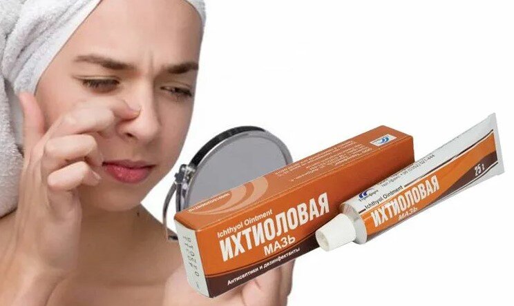 Мазь 19 века, которую в медицине так и не смогли заменить. Ихтиоловая мазь