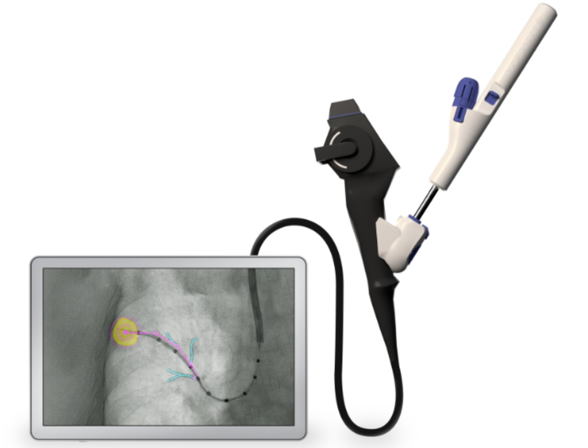 Body Vision Medical’s LungVision system.