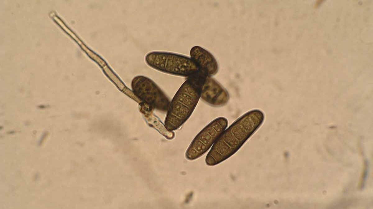 Фото: Анатолий Таракановский. Гельминтоспориум