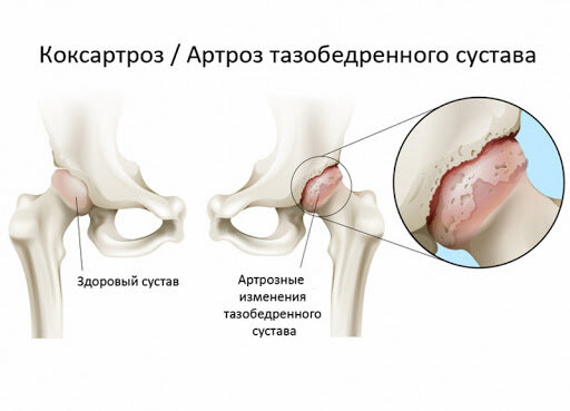 Тибетские пилюли для суставов 