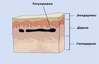 «Фантастические татуировки и как их удаляют»