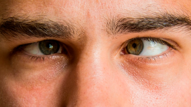 как называется болезнь когда бегают глаза