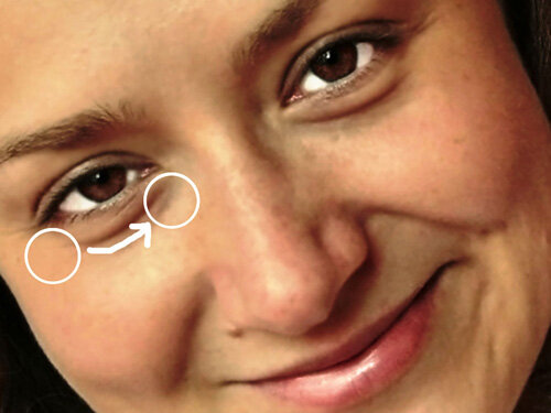 Отеки - симптом или заболевание?