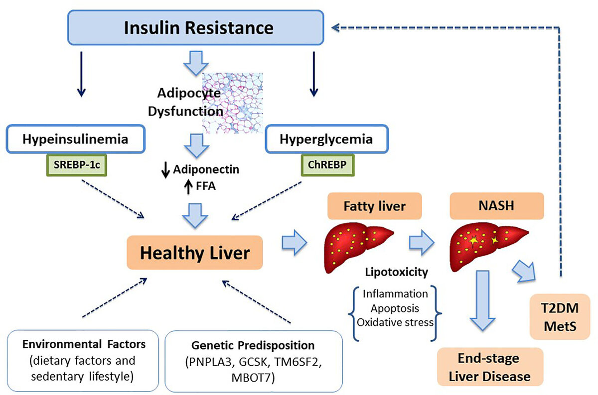Осложнение резистентности к инсулину - неалкогольная жировая болезнь печени