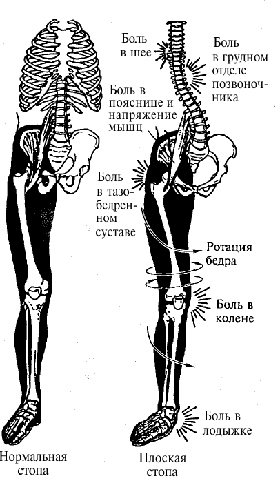Рисунок из книги Кашуба В. "Биомеханика осанки"