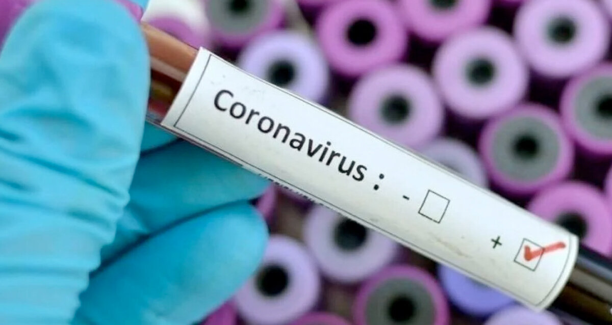 Коронавирус. Фото из открытых источников