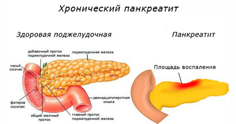 фото источник tbdoc.ru