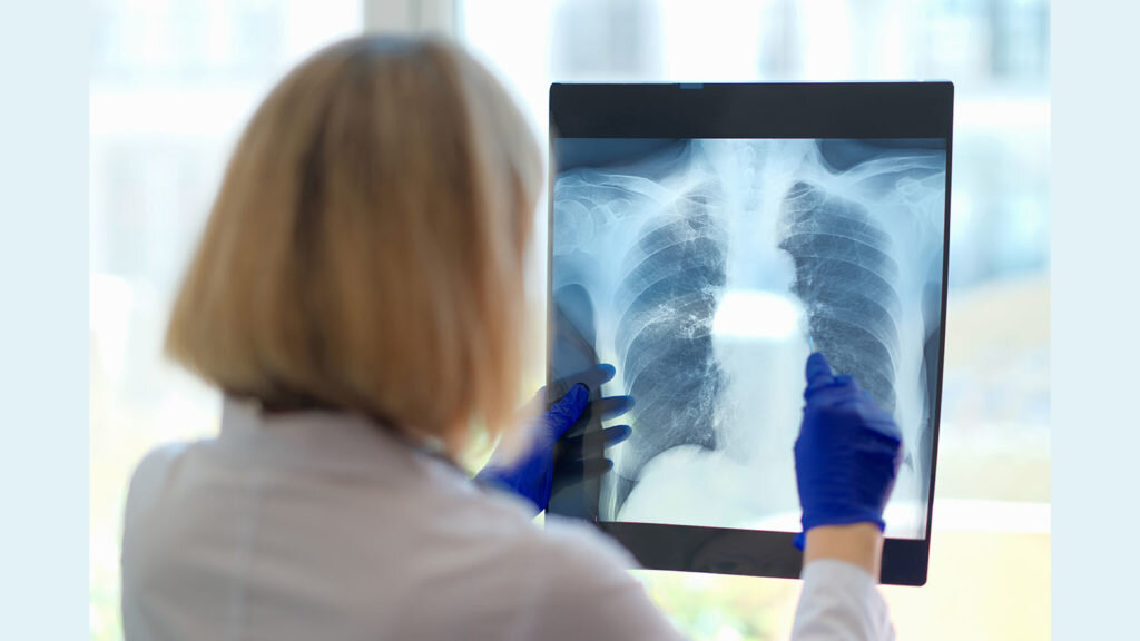    Doctor looks at x-ray in hospital. Medical specialist in radiology and medical sciences studies diseases. Expertise in medical care. Анастасия Никифорова