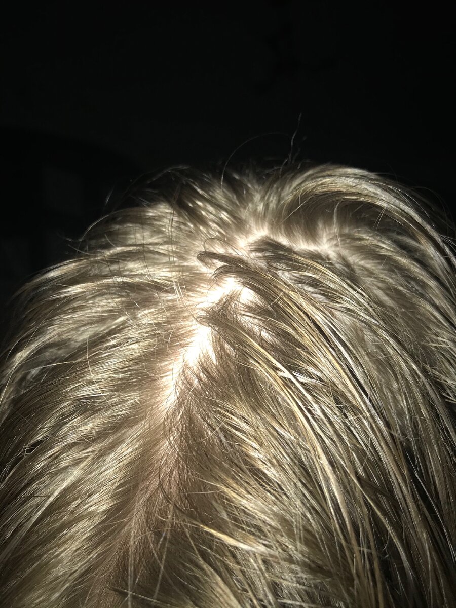 Как выглядят грязные волосы