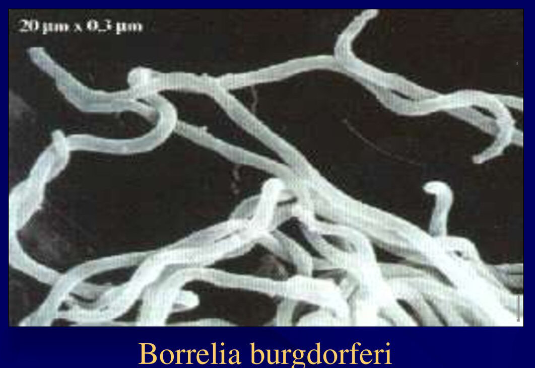 Borrelia burgdorferi s l днк обнаруж. Спирохета боррелия бургдорфери. Borrelia burgdorferi морфология. Боррелия бургдорфери строение.