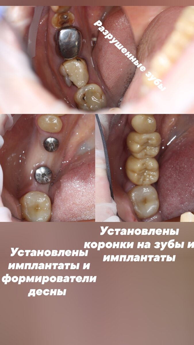 Чем опасна киста зуба? | Центр стоматологии ДИОНИС | Дзен