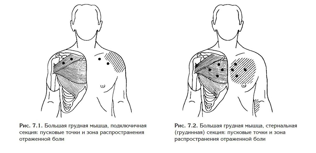 Является самой большой из четырех грудных мышц. Состоит из трех секций. Ключичная (верхняя) крепится к ключице, грудная (средняя) — к грудине, реберная (нижняя) — к мышцам ребер и желудка.