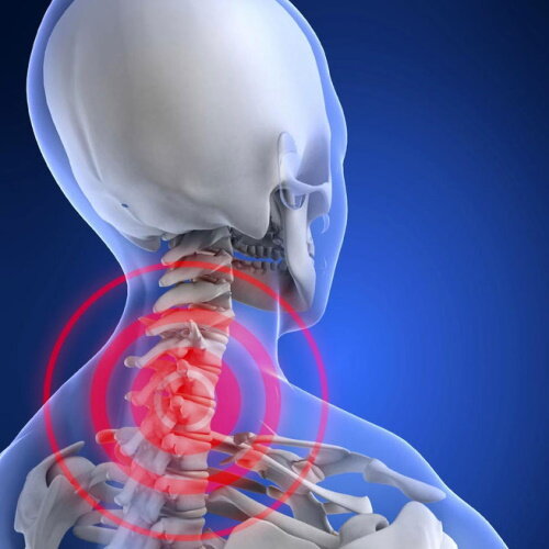 Грыжа и протрузии в шее