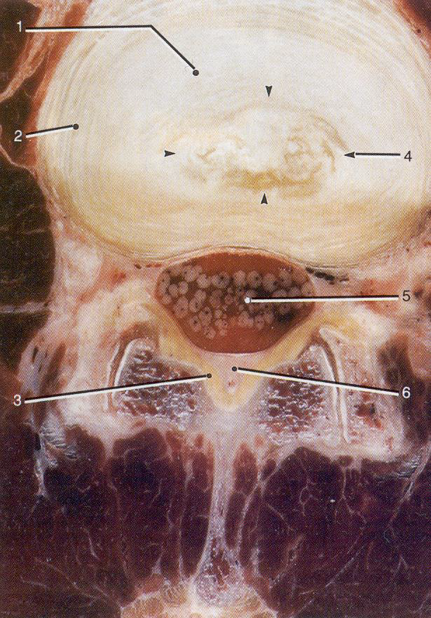                                         Анатомический срез
