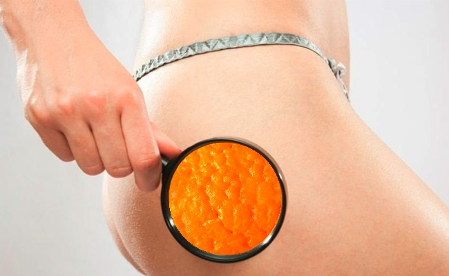 Попробуйте ходьбу, бег, плавание или катание на велосипеде в течение 30 минут ежедневно 3 раза в неделю.