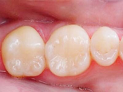 Источник: stomcentr32.ru