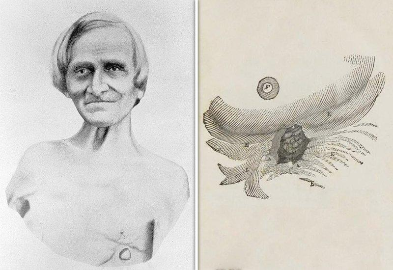 Алексис Сент-Мартин