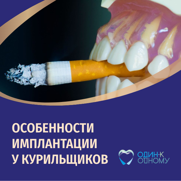 Имплантация зубов у курильщиков. Статья хирурга стоматологии "Один к Одному" в Перми