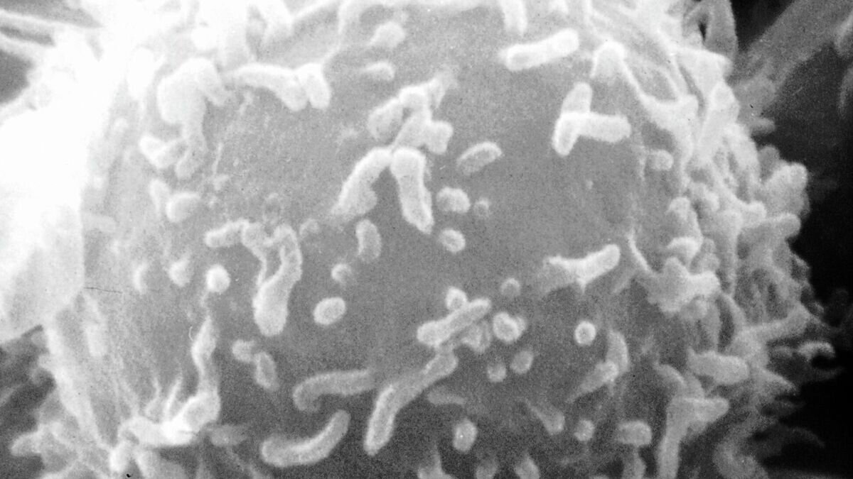    Снимок одного лимфоцита человека, получен сканирующим электронным микроскопомCC0 / Public domain /