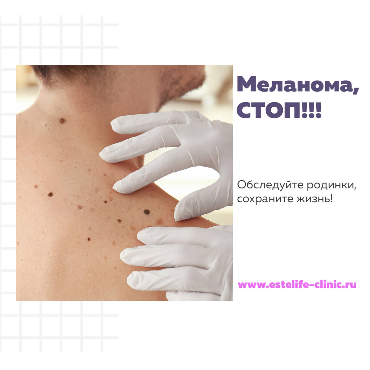 Доброкачественное или злокачественное новообразование - такой диагноз может поставить только квалифицированный специалист с высшим медицинским образованием