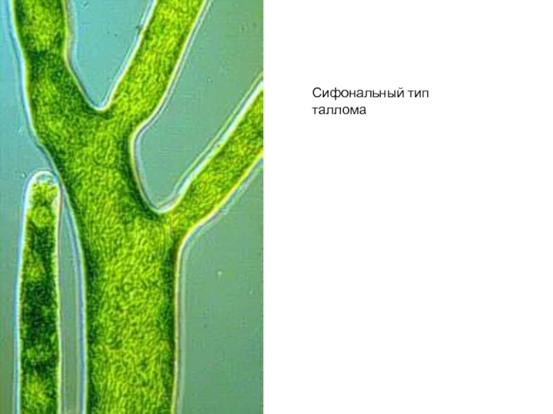 Зеленые водоросли имеют недифференцированный таллом. Сифональный таллом водорослей. Сарциноидный таллом. Сифональный Тип таллома. Сифокладиальный таллом.
